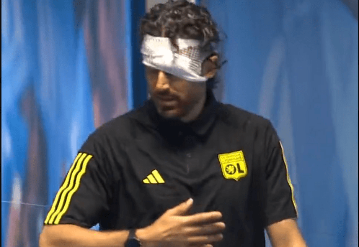 Fabio Grosso, DT del Lyon, habla tras herida por ataque a pedradas en Marsella