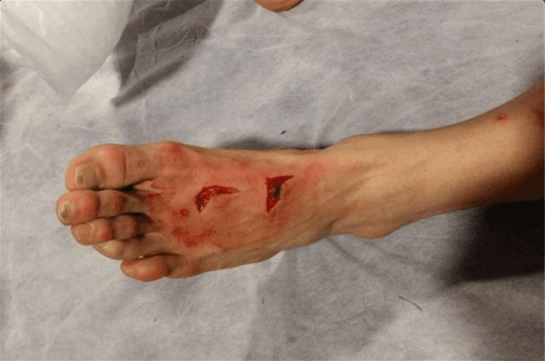 El corte que sufrió Héctor Herrera con el Porto en un partido ante la Juventus por Champions League.