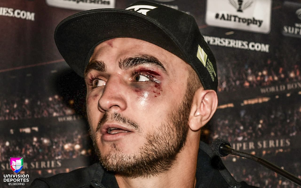 "Todos tienen un plan hasta que reciben un puñetazo en la boca", Mike Tyson.