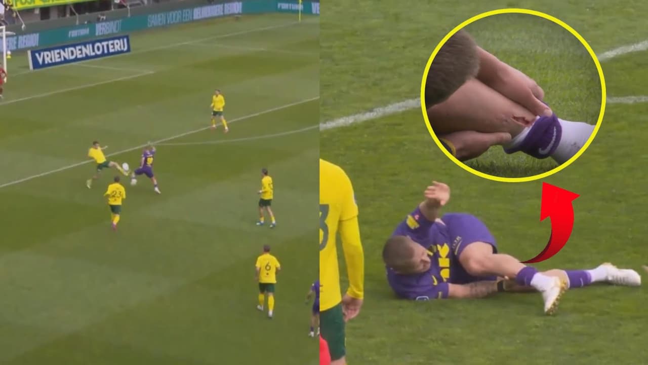 Escalofriante lesión sufre Lewis Holtby en duelo de la Eredivisie