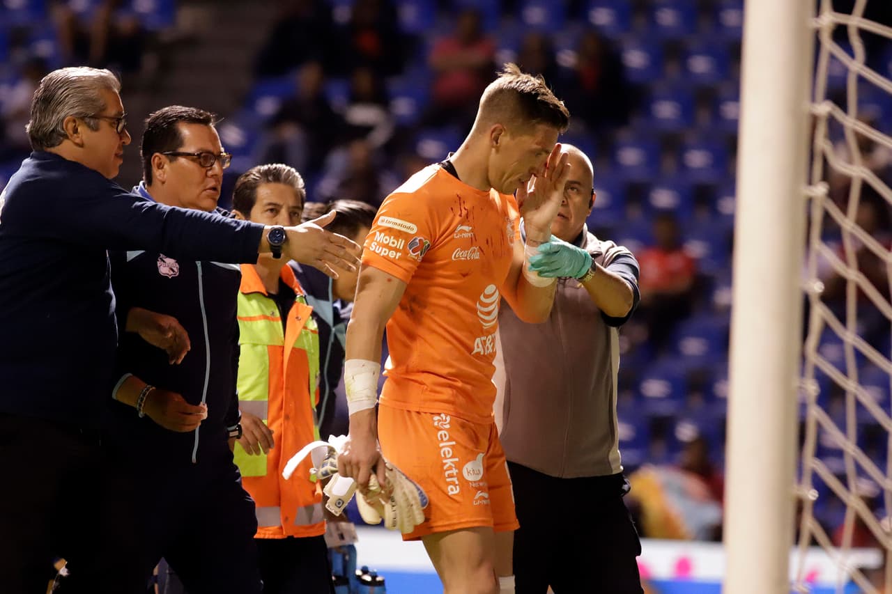 Vikonis chorreaba de sangre, la herida fue escandalosa y la atención meticulosa y tardada. Ya no pudo regresar al cotejo y fue remplazado por el suplente Jesús Rodríguez.