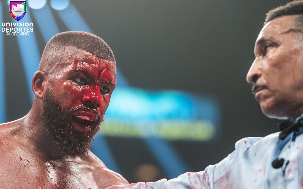 Aquí puede apreciarse de mejor manera le profundiad del corte y la mirada de preocupación de Tony Weeks, el réferi.