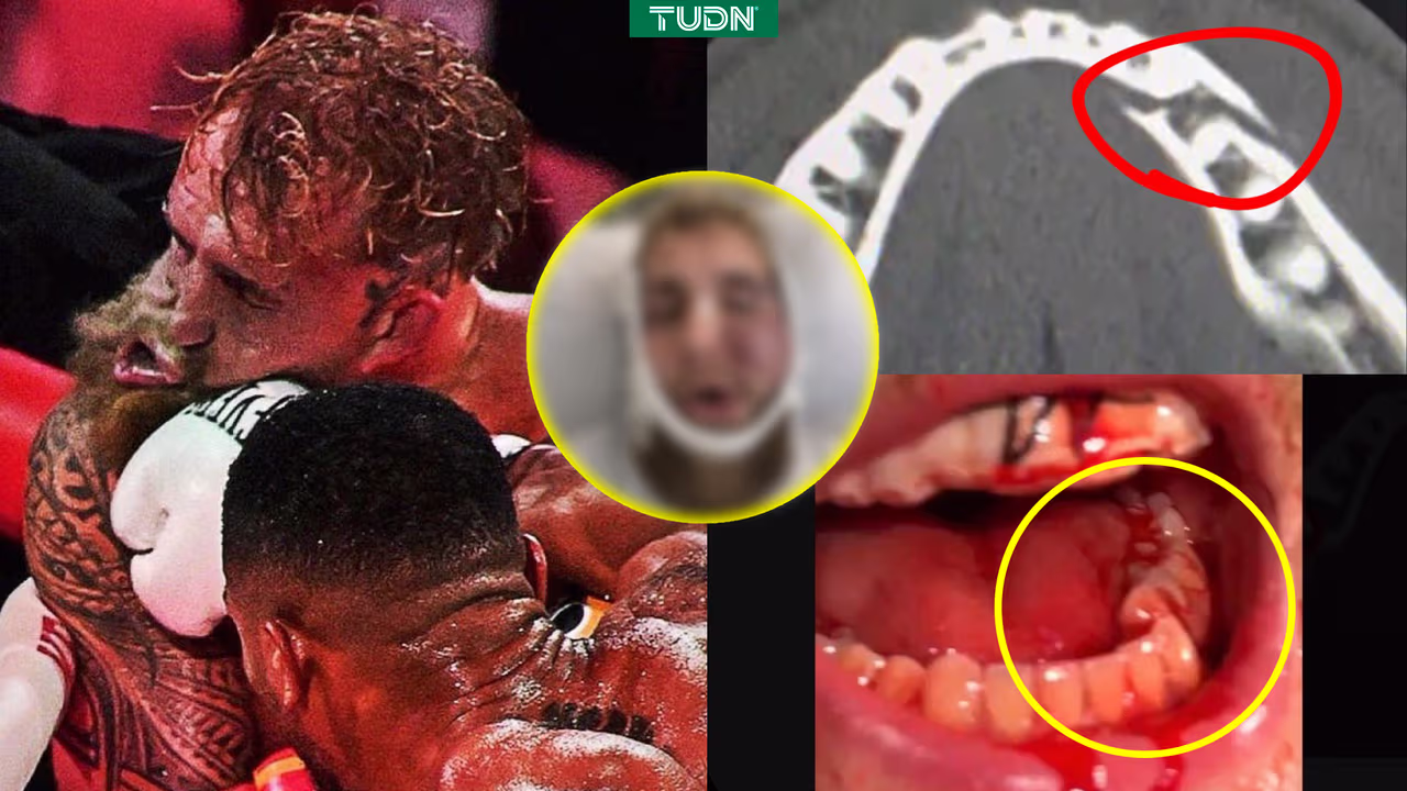 Así quedó el rostro de Jake Paul tras su pelea ante Anthony Joshua ...